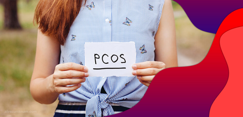 سندرم تخمدان پلی کیستیک (PCOS)